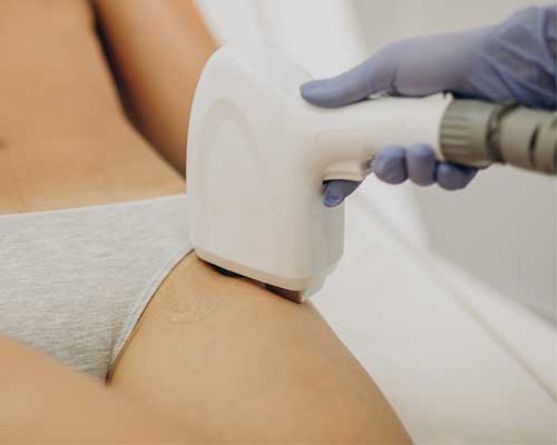 Depelação Laser de virilha